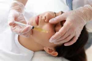 PRP Therapy